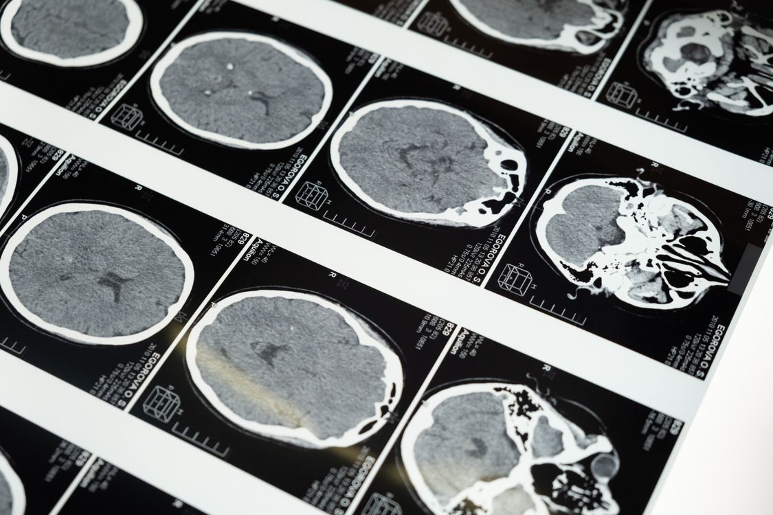 Medical diagnostics technology